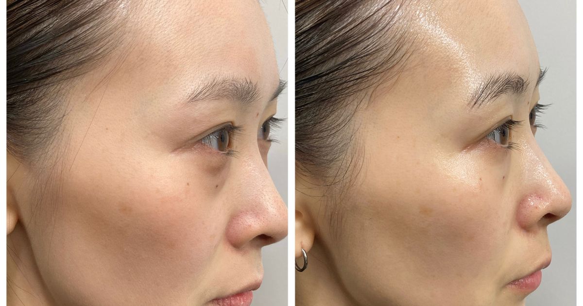 セルマンで艶肌❤︎